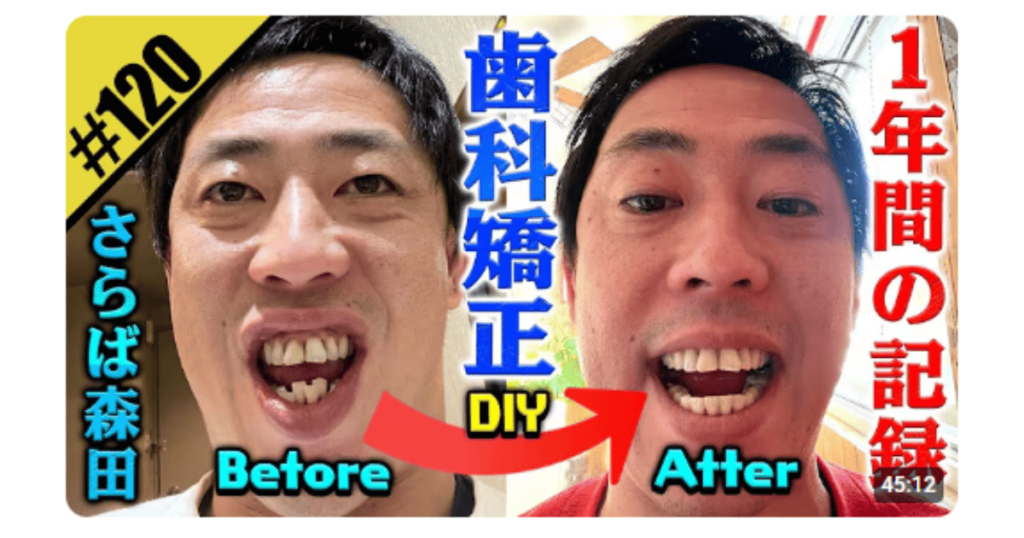 歯並びが悪い芸能人