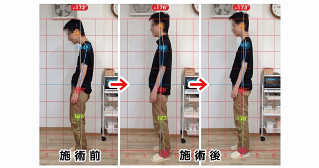 姿勢改善